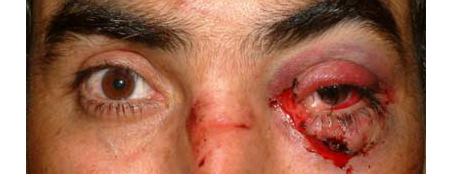 eyelid trauma damage bites injuries dog tear surgery denver services eyelids