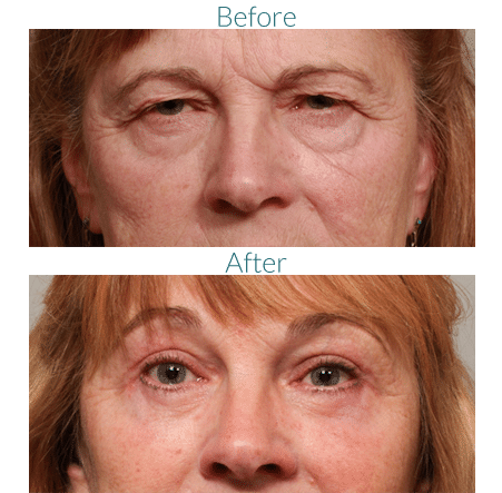 boulder-facial-surgery