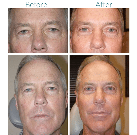 boulder-facial-surgery