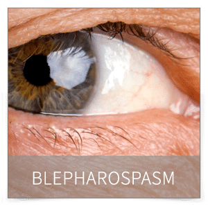 blepharospasm denver blepharospasm denver