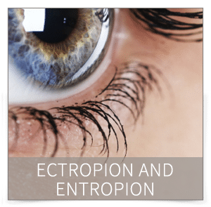 ectropion and entropion denver ectropion and entropion denver