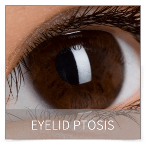 eyelid ptosis denver eyelid ptosis denver