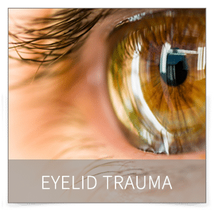 eyelid trauma denver eyelid trauma denver