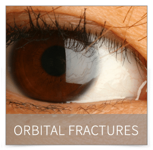 orbital fractures denver orbital fractures denver
