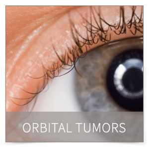 orbital tumors denver orbital tumors denver