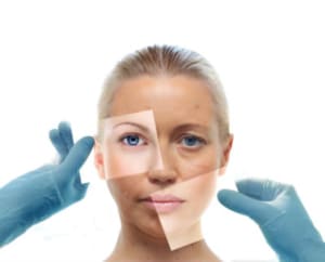 Skin Aging | Denver CO