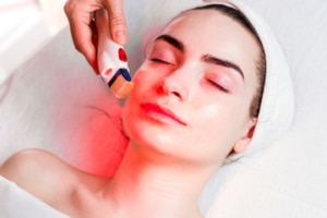 Microneedling denver co | Fante Eye and Face Centre