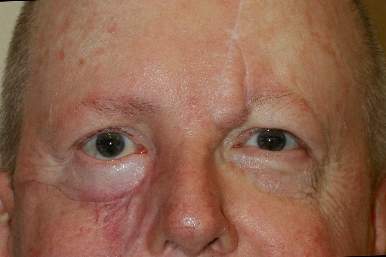Case 3 image 3