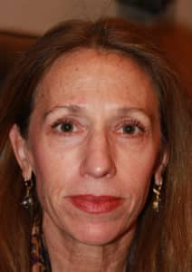 Lower Blepharoplasty and Laser Resurfacing
