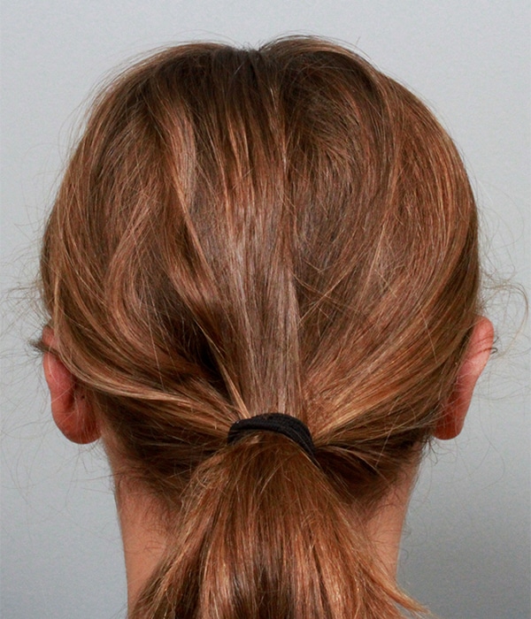 After Image: Otoplasty - back