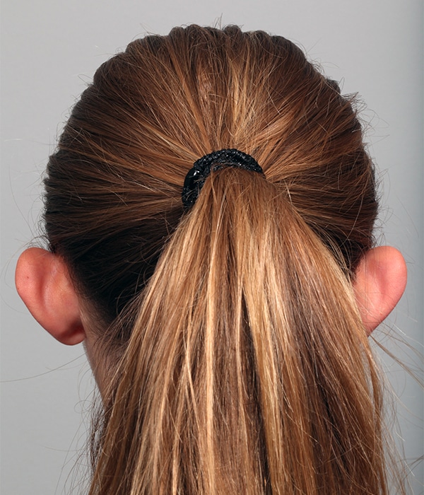 Before Image: Otoplasty - back