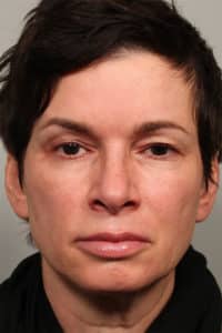 Upper Blepharoplasty and Left Eyebrow Lift