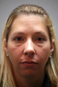 Lower Blepharoplasty