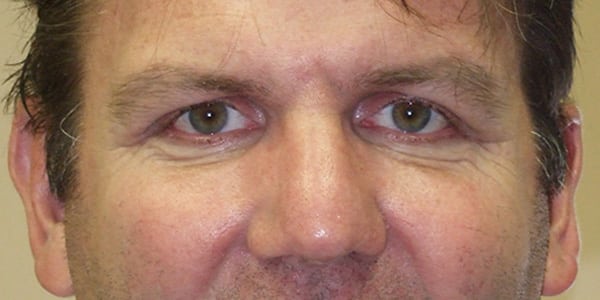 After Image