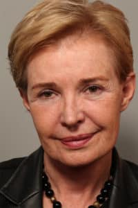 Facelift and Necklift