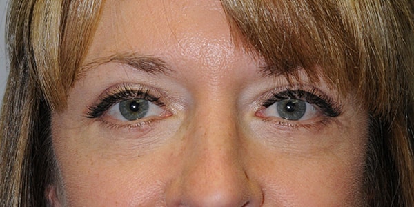After Image