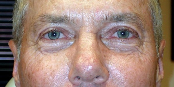 After Image