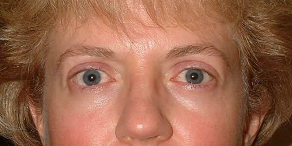 After Image