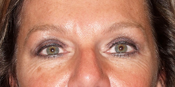 After Image