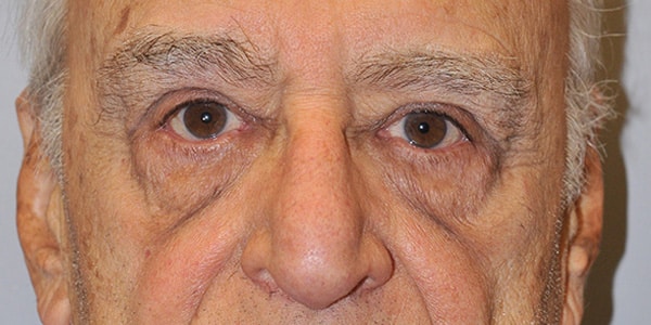After Image