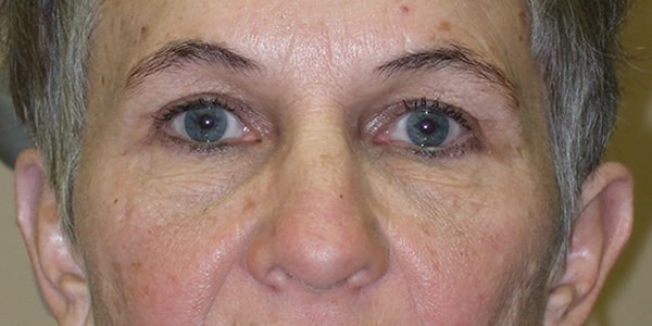 After Image