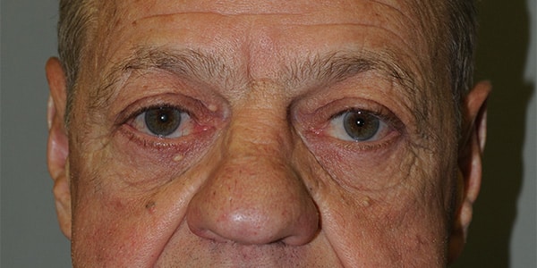 After Image