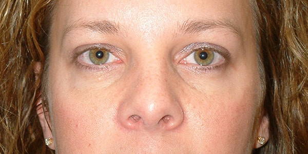 After Image