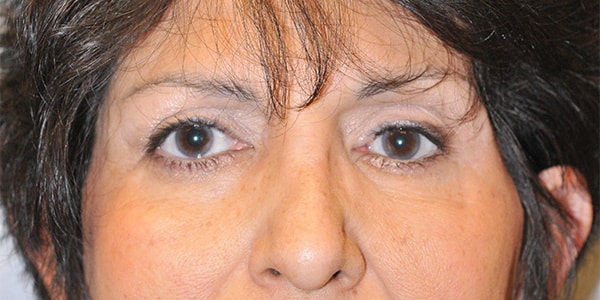 After Image