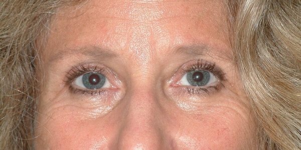 After Image