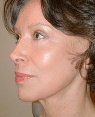After Image