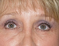 After Image