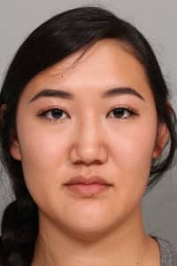 Asian Blepharoplasty