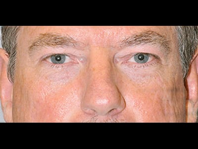 After Image
