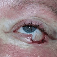 After Image