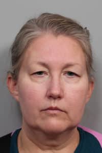 Before Image: Facelift, Necklift, Upper & Lower Blepharoplasty, Laser Resurfacing, Fat Transfer to Perioral and Lips