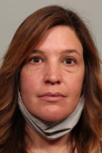 Upper and Lower Blepharoplasty