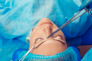 facial gender affirmation surgery