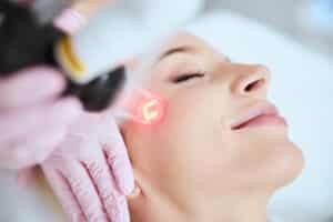 Close up of woman relaxing and receiving laser resurfacing treatment