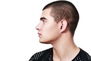 Side profile of teen boy, showing his ears after otoplasty in Denver, CO