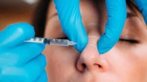 Close up of dermal filler injections for the nose for facial feminization in Denver, CO
